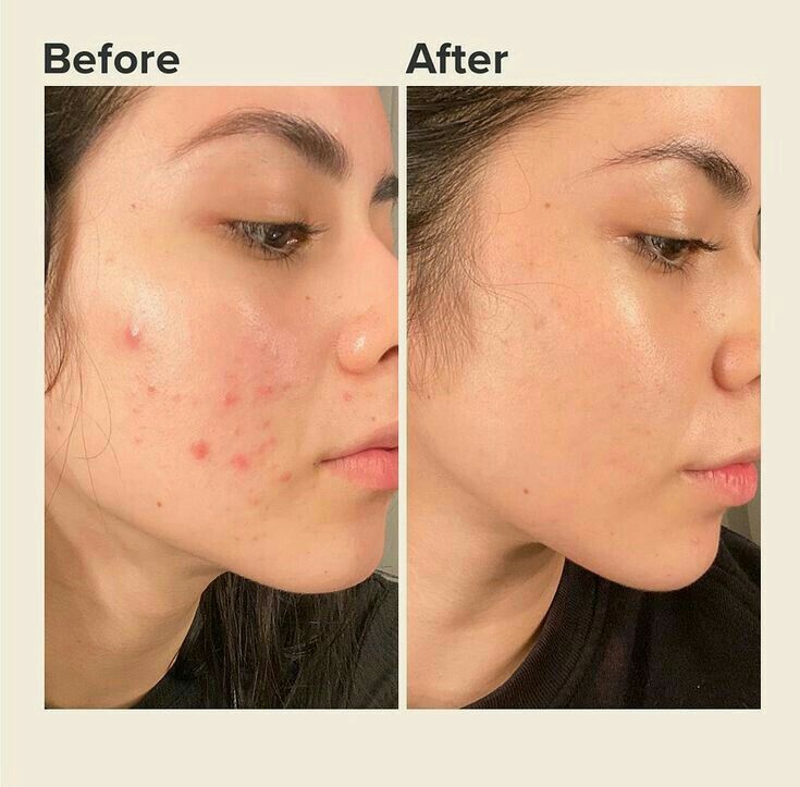 Axis-y Dark Spot Correcting Glow Serum
