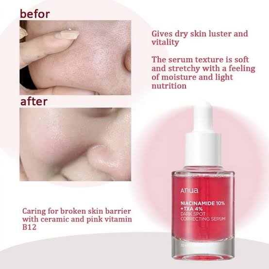 Anua Niacinamide 10% + TXA 4% Dark Spot Correcting Serum - 30ml